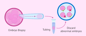 PGS procedure