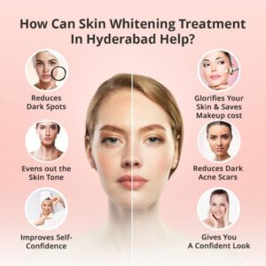 opt for skin whitening treatments